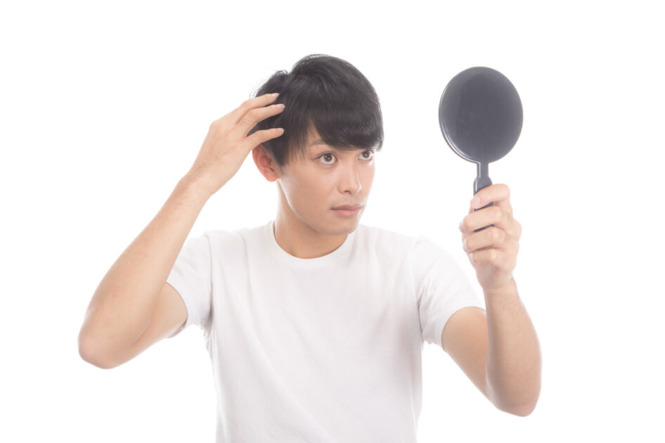 毛髪を気にする男性